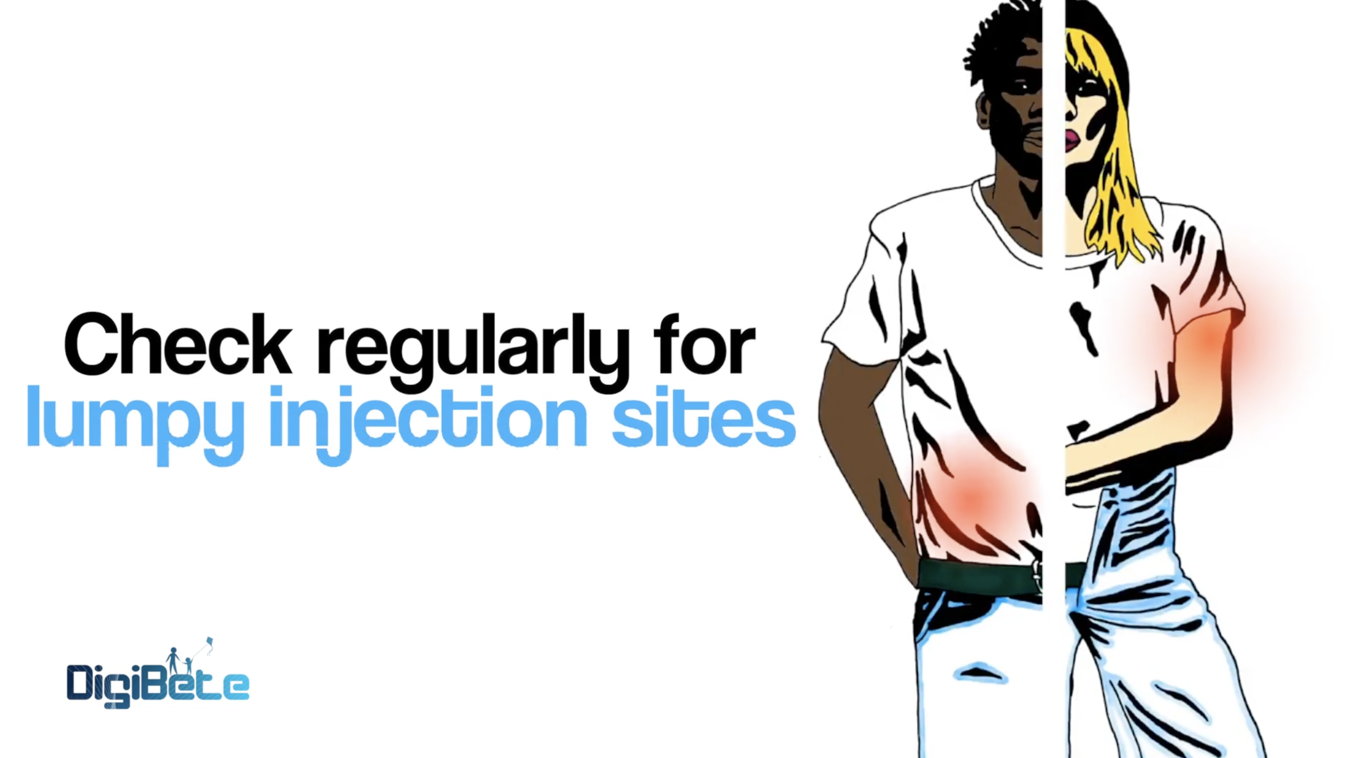 Diabetes Essentials : Check Regularly for Lumpy Injection Sites