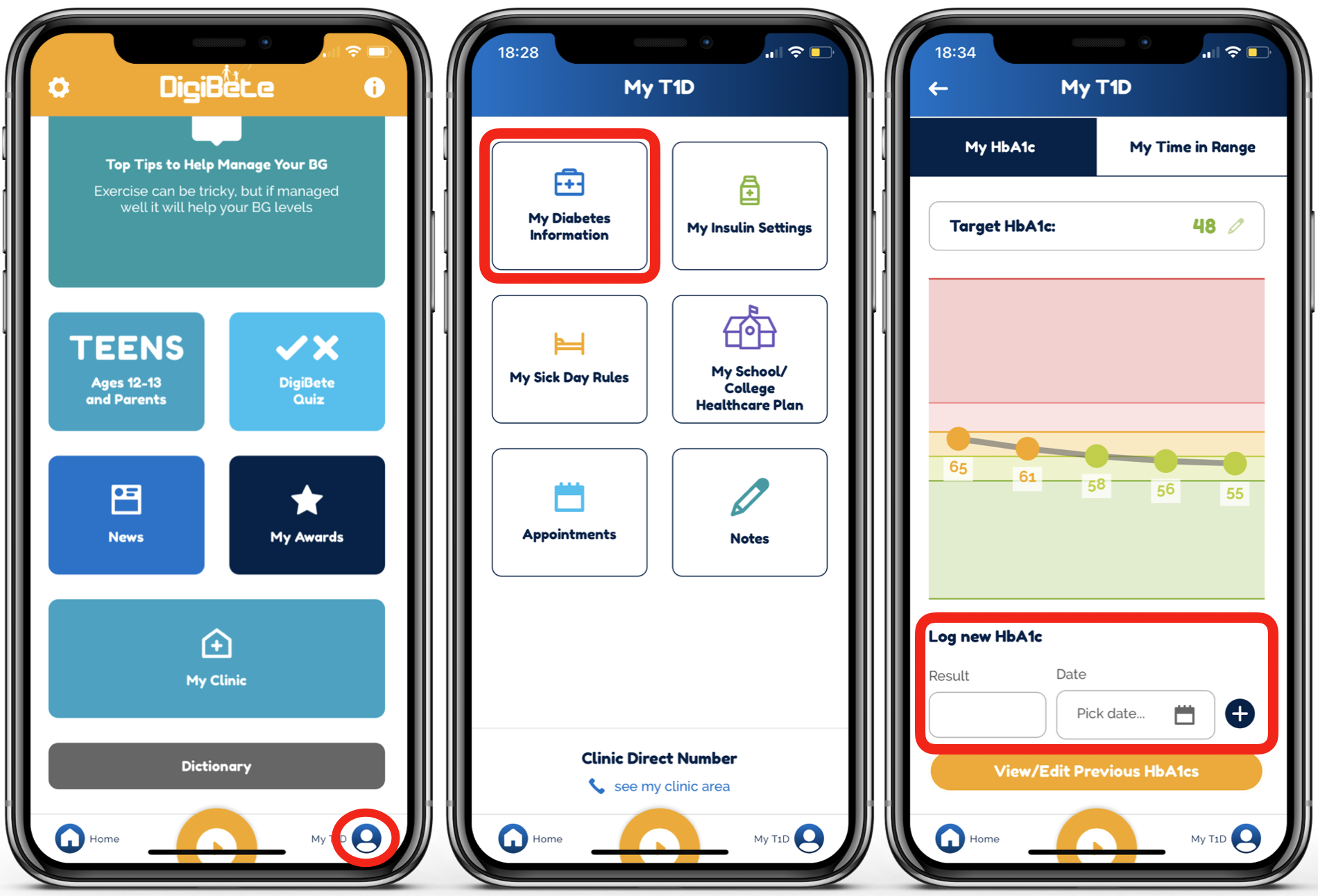 The DigiBete App Update : New HbA1c Tracker