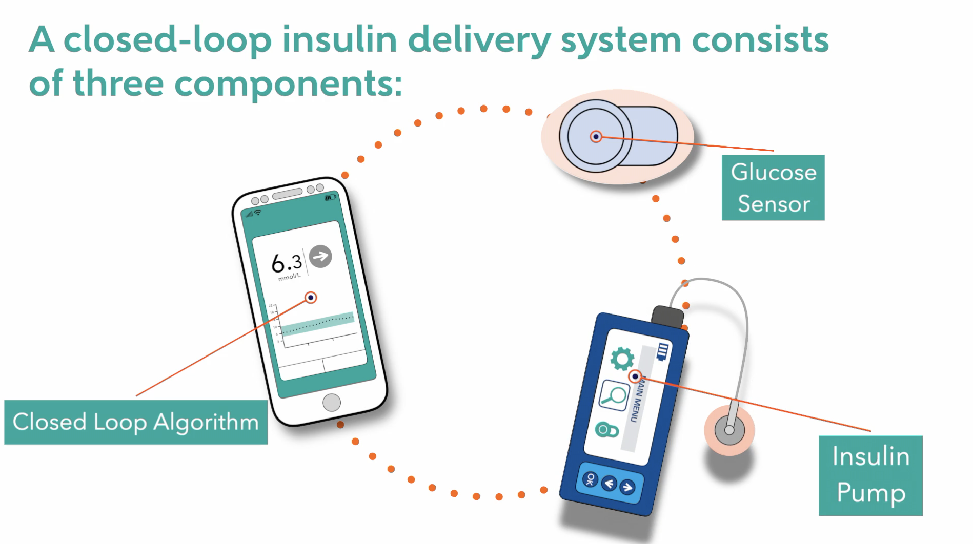 KidsAP Study Shows Huge Benefit with Closed-Loop System for Children's Diabetes Self-Management