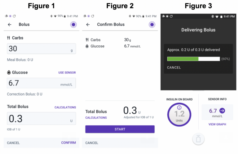 Urgent Information Regarding the Omnipod® 5 Automated Insulin Delivery System